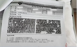 出國看病讓患者有尊嚴的活著！