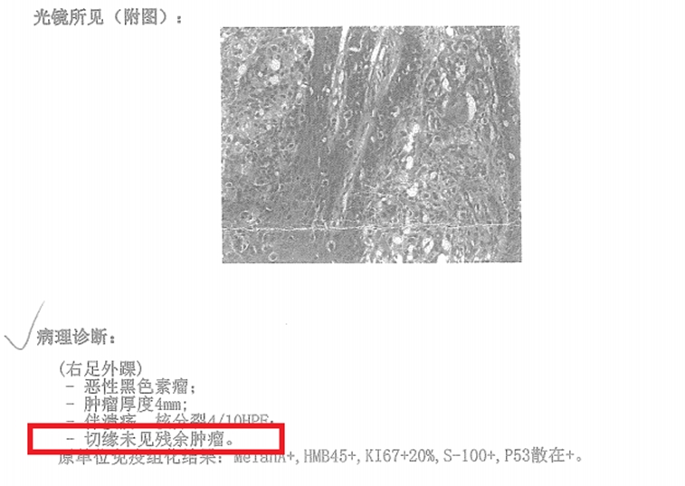 腫瘤醫(yī)院病理報告.jpg