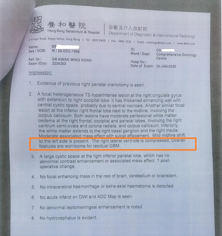 腦腫瘤殘留.jpg