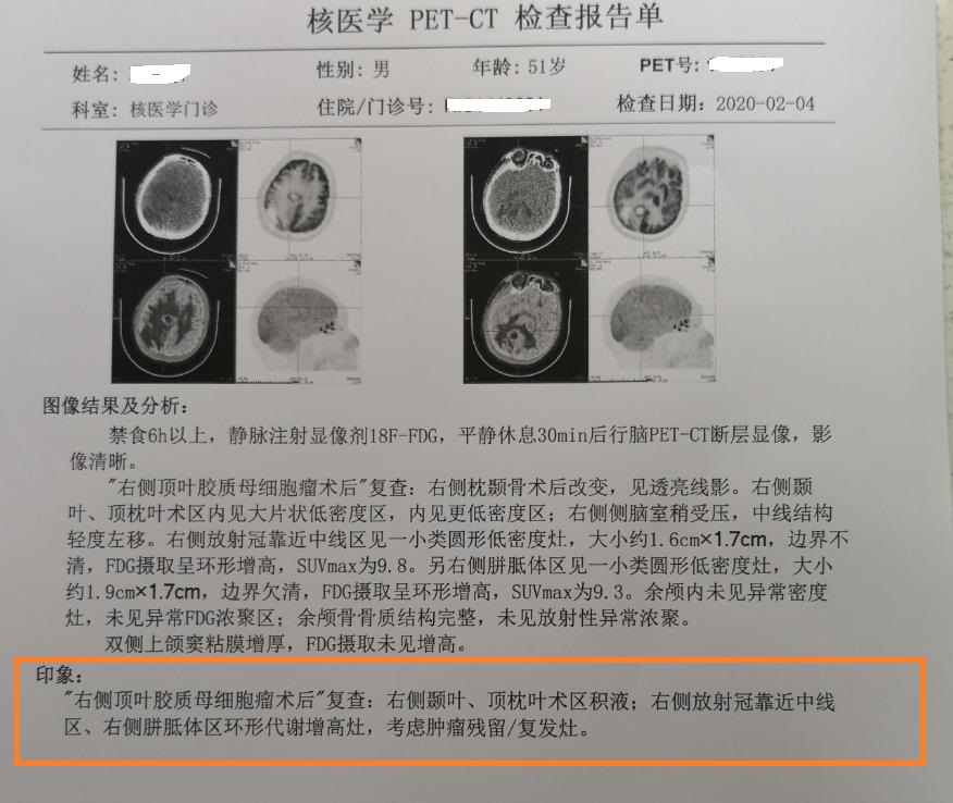 復(fù)發(fā)灶.jpg