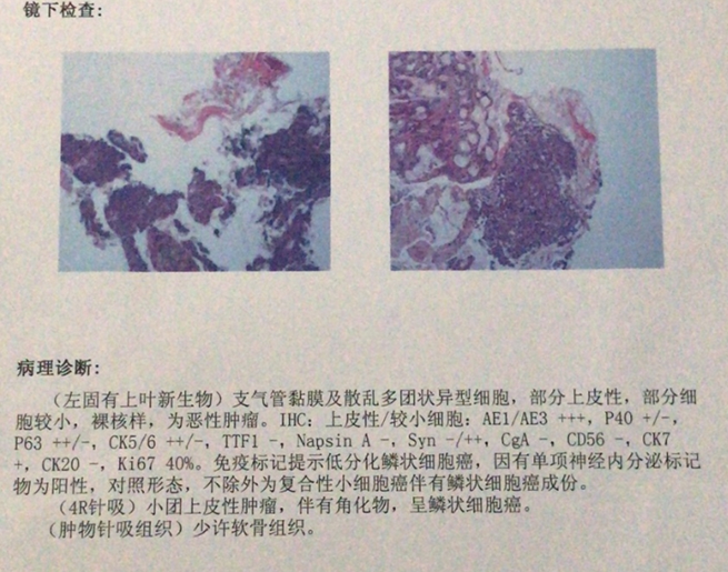 病理報告.jpg