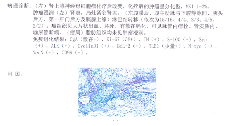 病理報告.jpg