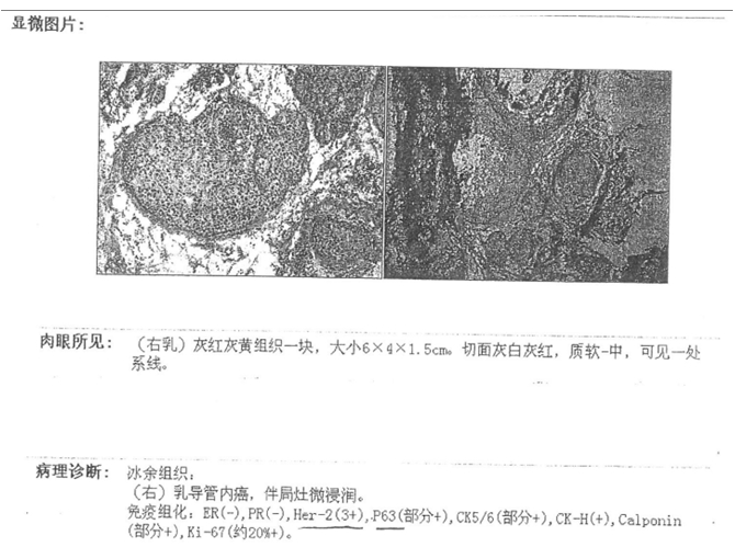 病理報告.jpg
