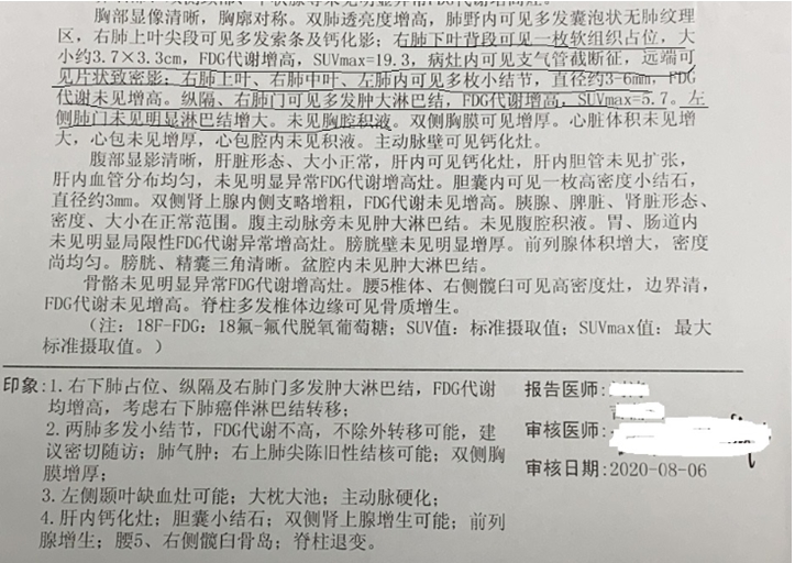 PET-CT報(bào)告.jpg