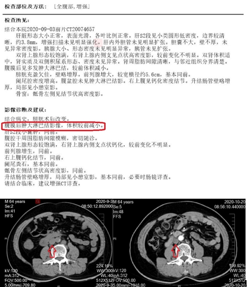 美國治療方案.jpg