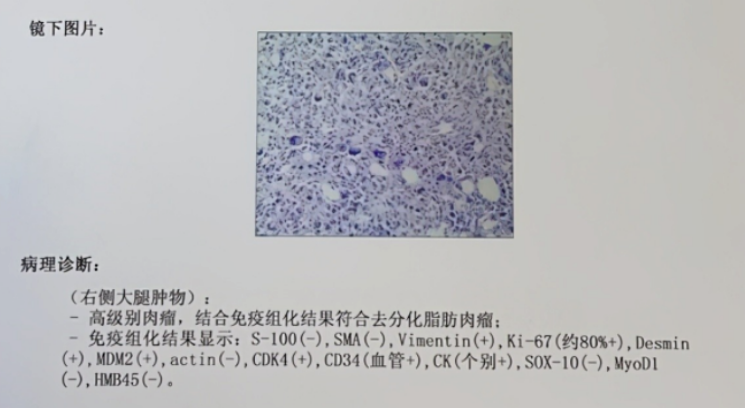 安羅替尼.png 安羅替尼.png