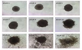 一種對(duì)腫瘤有毒的omega-3，該如何應(yīng)用？