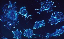 海外專家發現完整的肺鱗狀細胞癌分子圖