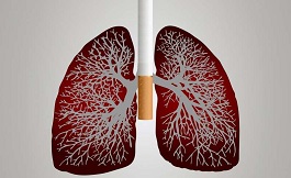 海外研究：預測非小細胞肺癌治療的模型
