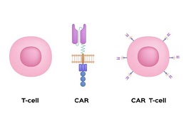CAR T療法在難治性前列腺癌中初露端倪