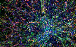 人工智能可為兒童腦癌確定新的藥物組合