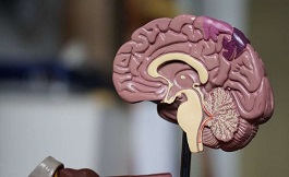 存活率與腦癌細胞質量變化之間的聯系