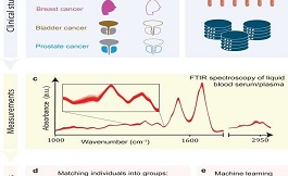 紅外光譜分析可檢測實體瘤的分子痕跡