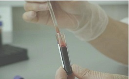 等離子體在白血病治療中的潛在作用