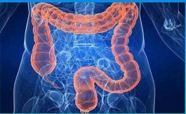海外研究：遺傳性的結腸癌更為常見