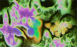 科學家發現了部分癌癥轉移的起源