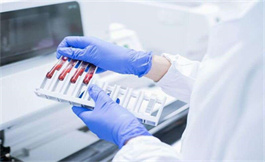 血液生物標志物可能有助于淋巴瘤治療