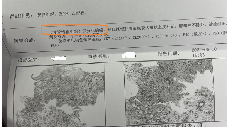 病理診斷報告.png