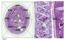 科學家強調了有害腸道細菌在患者發燒中的作用