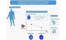 用于 PET 成像的新工具允許對腦腫瘤進行評估
