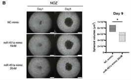 海外醫療：有關耐藥膽道癌的新型靶向分子治療