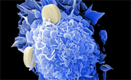 評價 selpercatinib 治療非小細胞肺癌的療效！