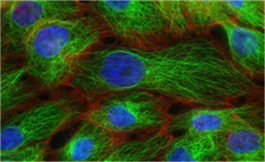 FDA 授予復發/難治性 AML 的 CB-102 快速通道稱號