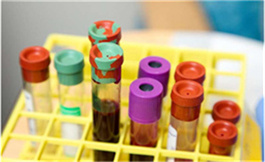 Momelotinib 對骨髓纖維化患者貧血顯示出積極影響