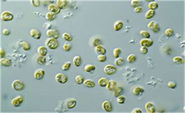 類固醇患者中，二線后 Axatilimab 能產生 ORR 益處