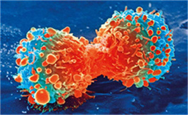 出國看病：晚期黑色素瘤中 relatlimumab 與 Ipilimumab 療效相當(dāng)