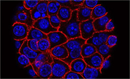 Nivolumab 在晚期 RCC 中能維持生存期并產生持久反應
