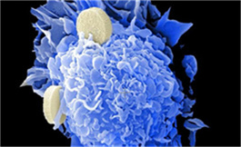 西伐替尼在晚期 her2 突變型 NSCLC 中能誘導(dǎo)持久應(yīng)答